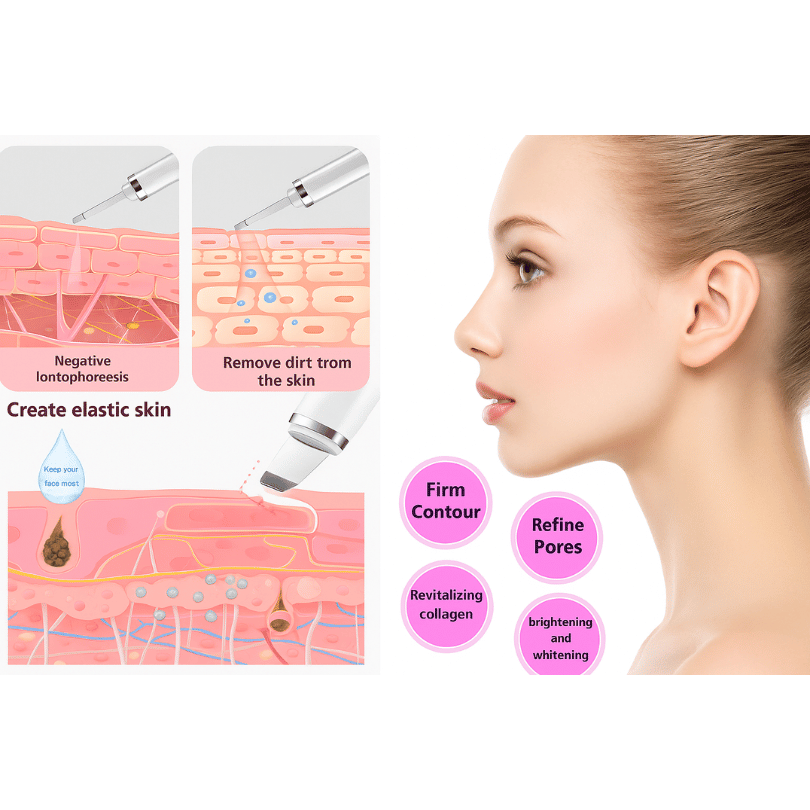 Ultrasonic Skin Scrubber – Deep Facial Cleansing & Exfoliation Tool - E11 Store