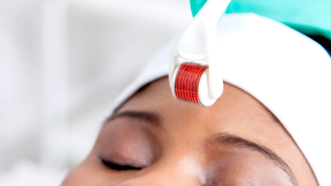 I Tried At-Home Microneedling—and It Totally Changed My Skin - E11 Store